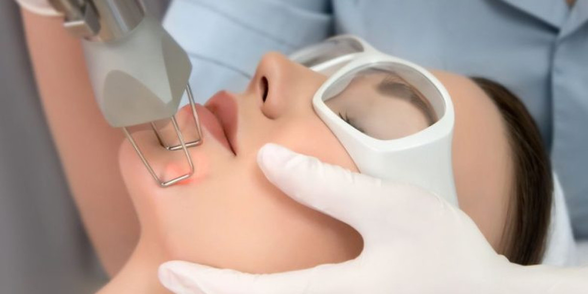 Fractional CO2 Laser Treatment in Dubai: Transforming Skincare