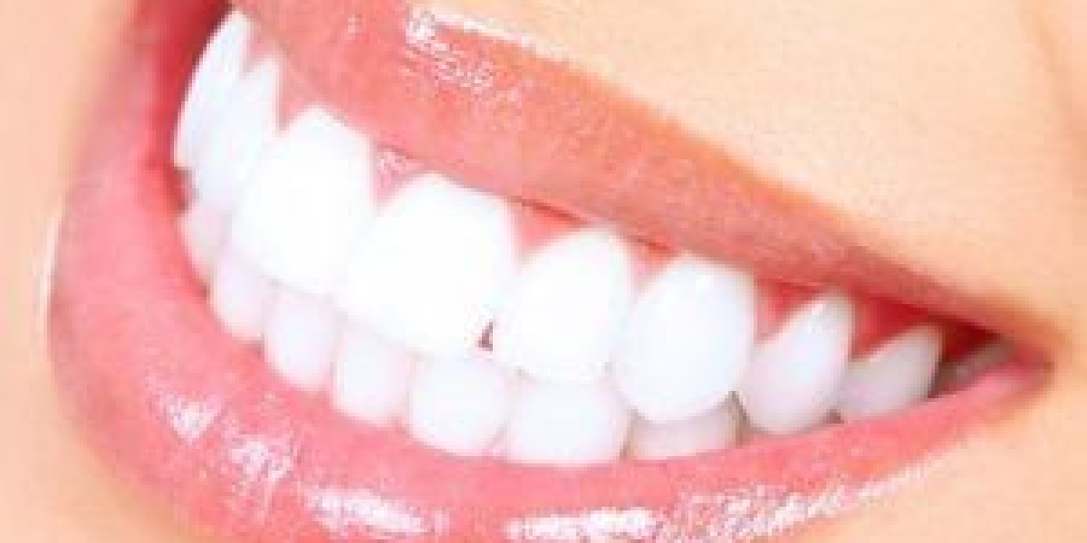 Safe and Effective Teeth Whitening Solutions in Dubai