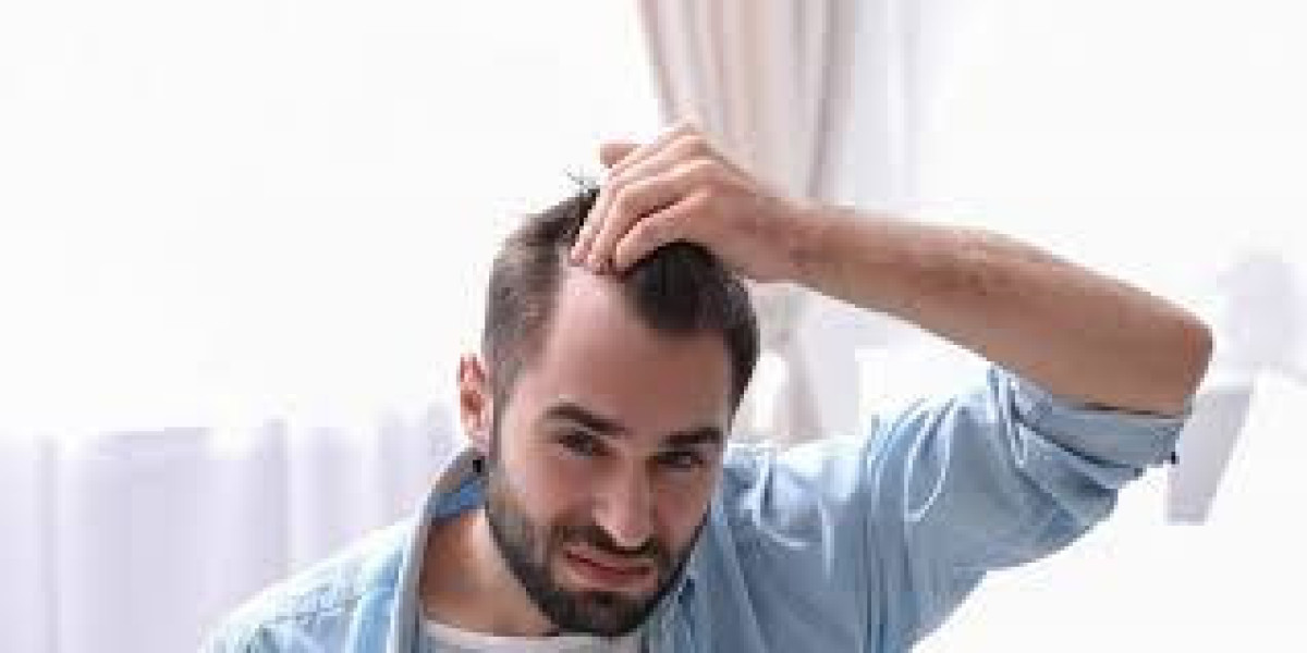 Hair Transplant in Riyadh: Techniques, Costs, and Benefits