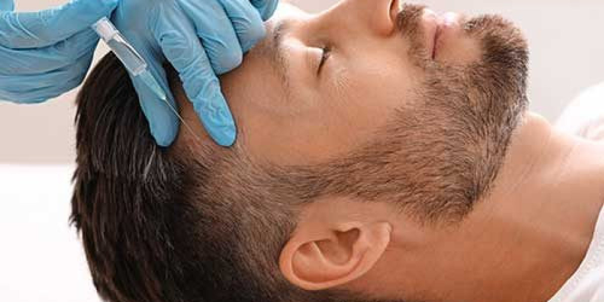 Hair Loss Treatment in Indirapuram- Dr. Anima Mishra