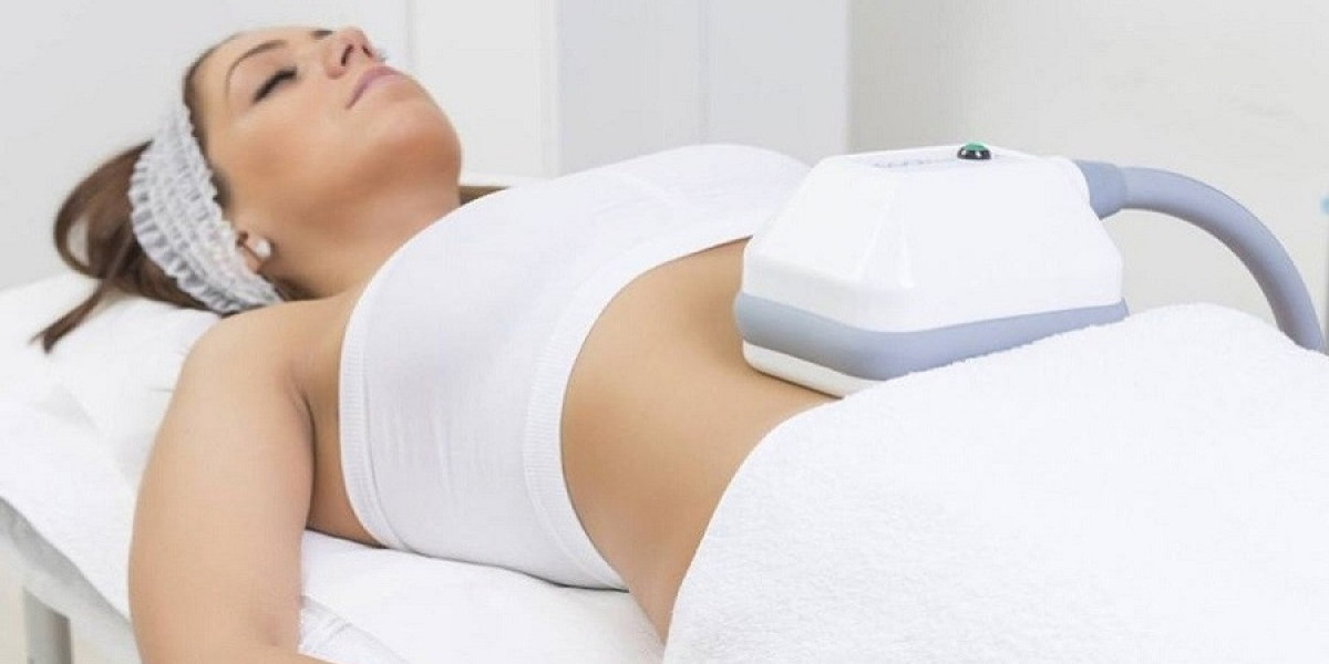 CoolSculpting Marvels: The Art of Frozen Perfection