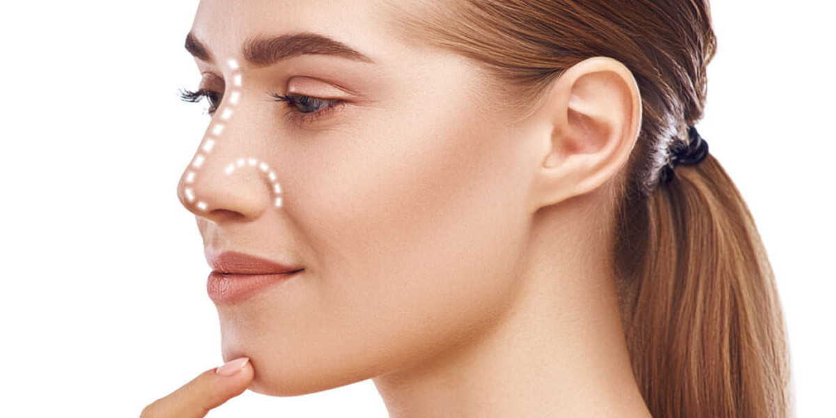 Rhinoplasty in Islamabad: A Comprehensive Guide