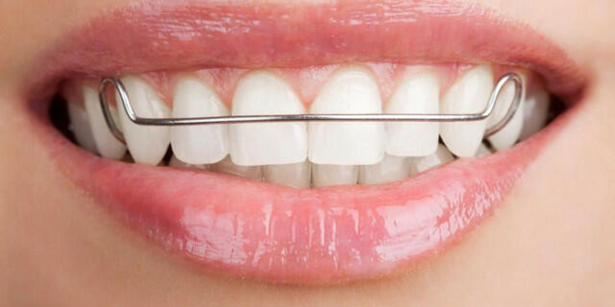 Teeth Straightening in Riyadh: How Much Will It Set You Back?