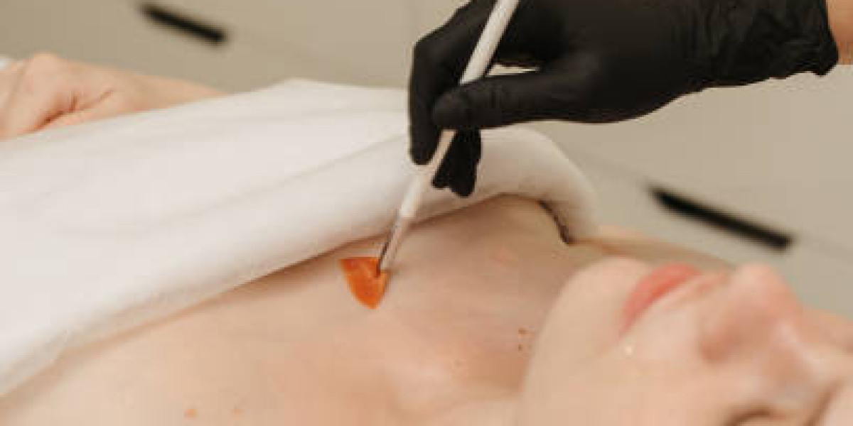 Transform Your Skincare with Glycolic Peels in Riyadh