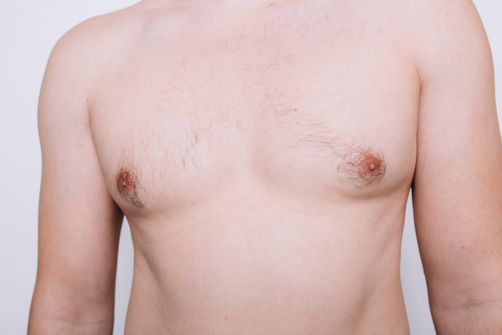 Gynecomastia Eradication: Dubai’s Cutting-Edge Solutions – Site Title