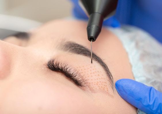 Eyelid Surgery : The Key to Unlocking Your Potential