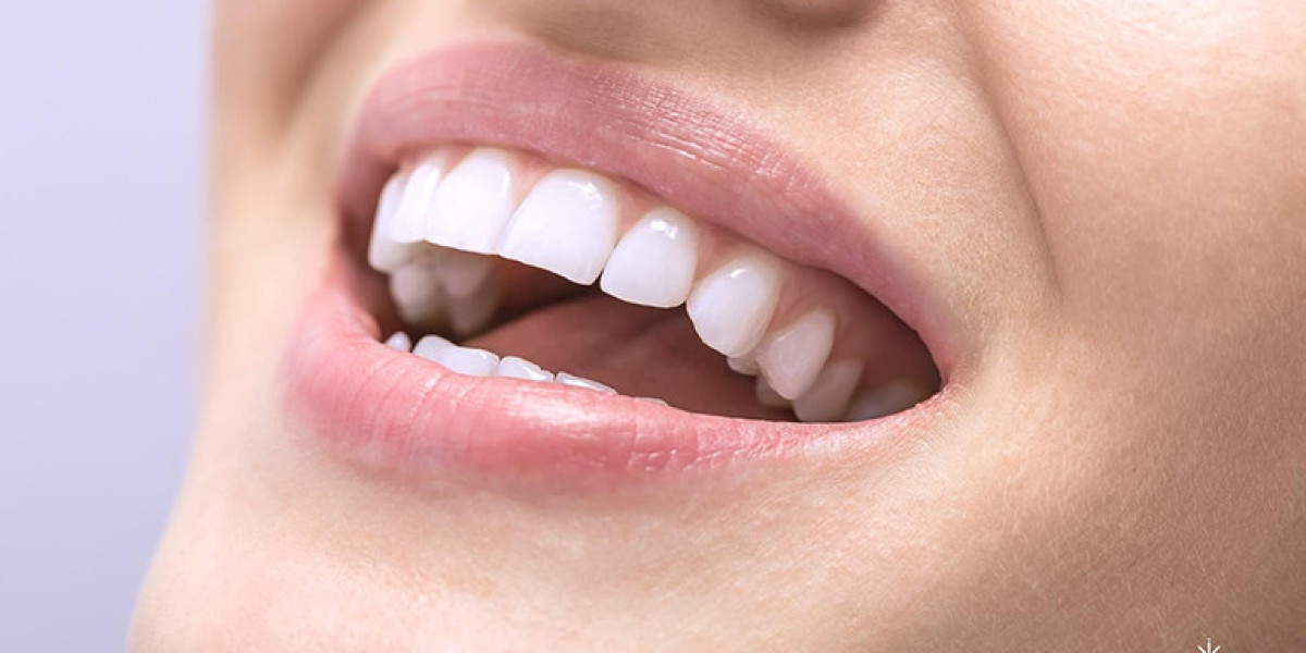 Teeth Whitening for Sensitive Teeth: Options in Dubai