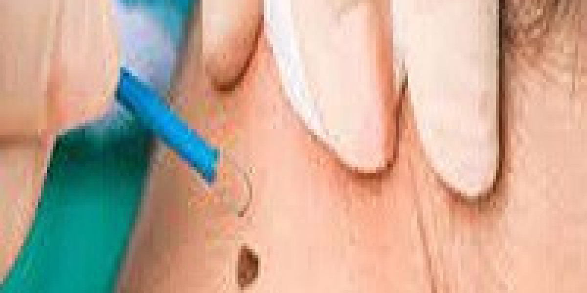 "Achieve Blemish-Free Skin with Mole Removal in Dubai"