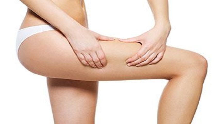 Everything You Need to Know About Thigh Lift Surgery