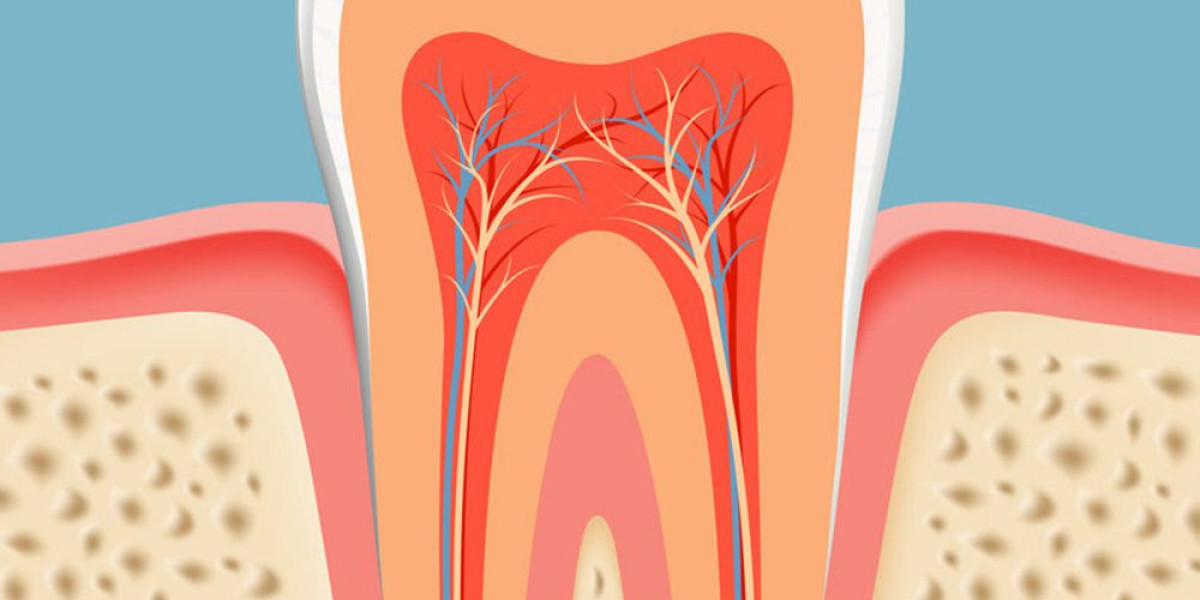 Root Canal Therapy: Myths vs. Facts – What Dubai Patients Need to Know