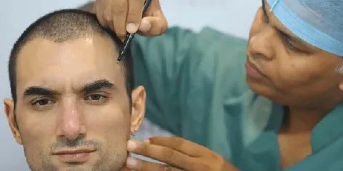 Innovative Hair Transplantation Technologies in Al Ain