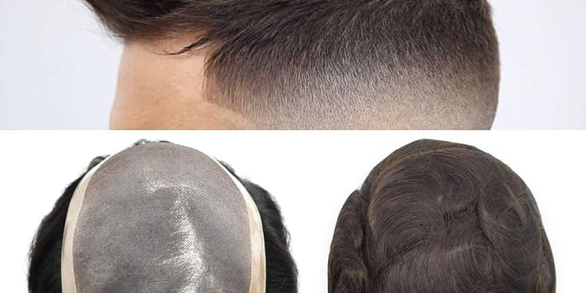 Hairpieces for men- Improve Hair Quality