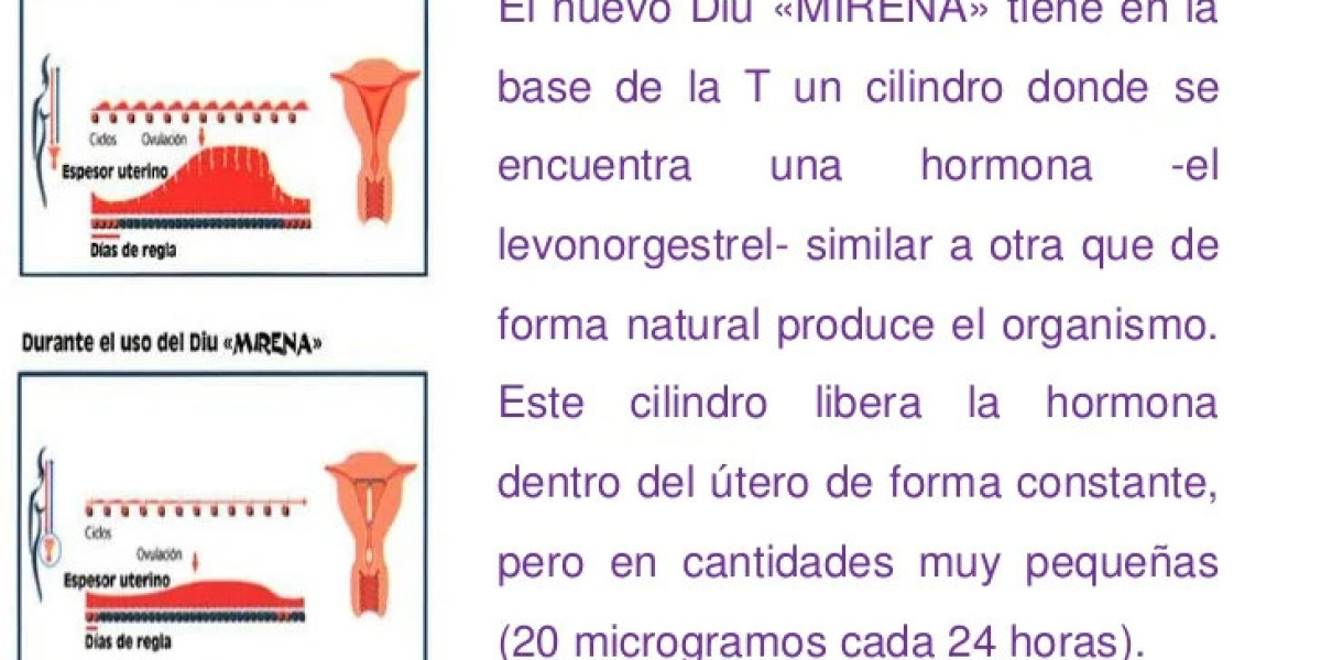 ¿El DIU Mirena y el Aumento de Peso? Mitos y Realidades Que Debes Conocer