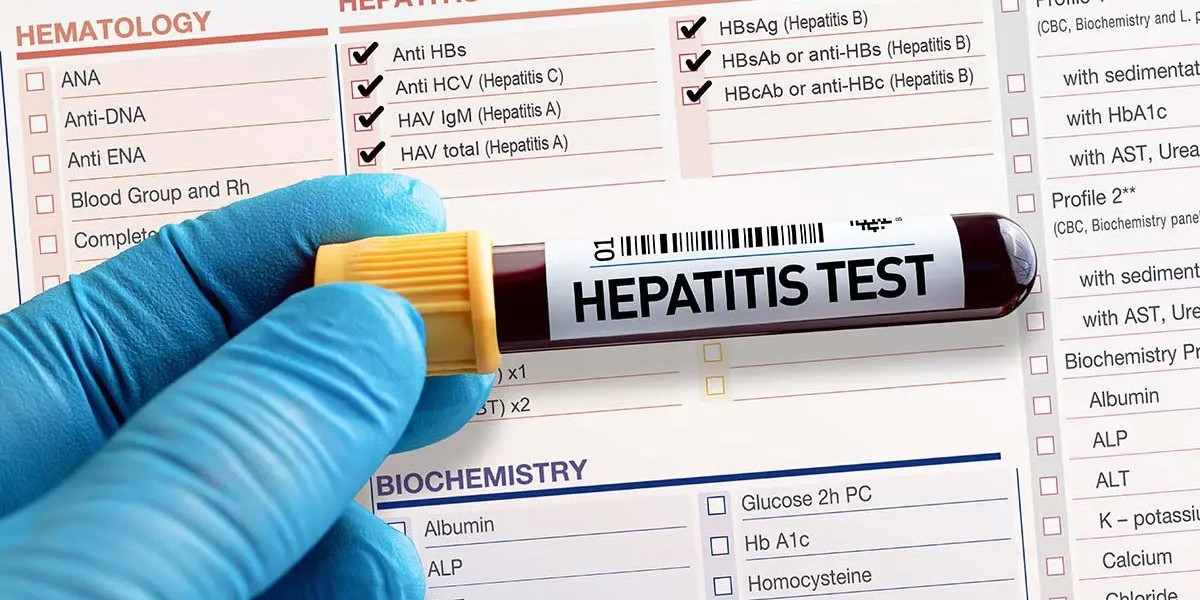 Rising Hepatitis Cases Fuel Growth in Diagnostic Test Solution Market