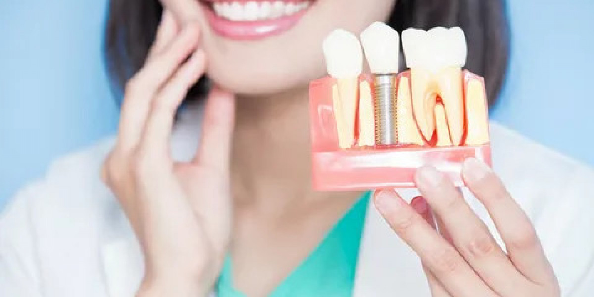 Why Islamabad is a Hub for Advanced Dental Implants