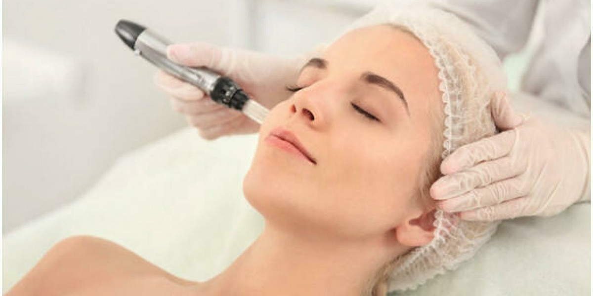 Can Microneedling Treat Fine Lines and Wrinkles? Exploring the Benefits