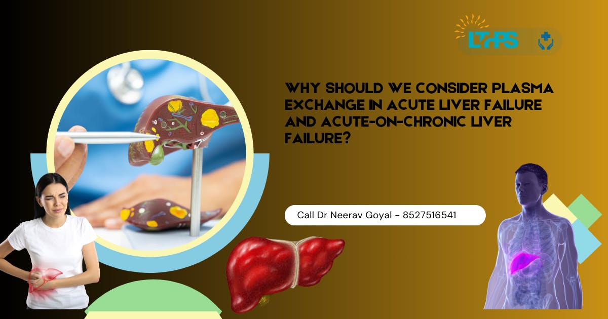 Why should we consider plasma exchange in acute liver failure and acute-on-chronic liver failure?