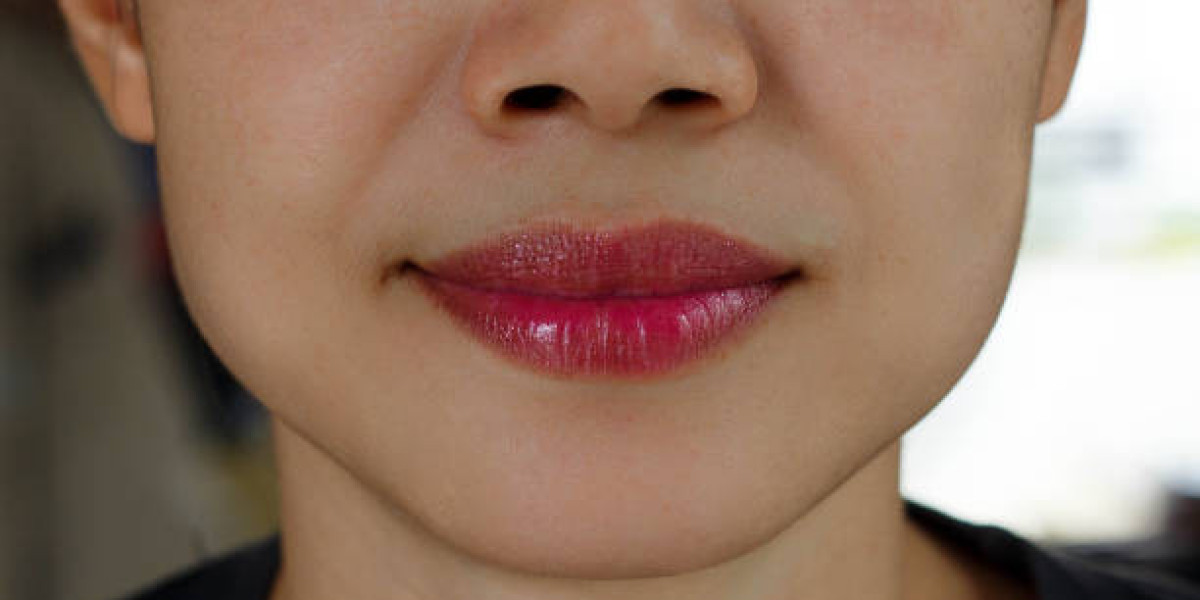 Lip Thinning in Riyadh: Expert-Approved Techniques