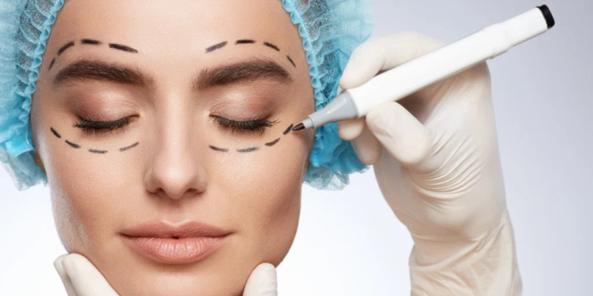 Unlocking a New Look with Eyelid Surgery in Islamabad