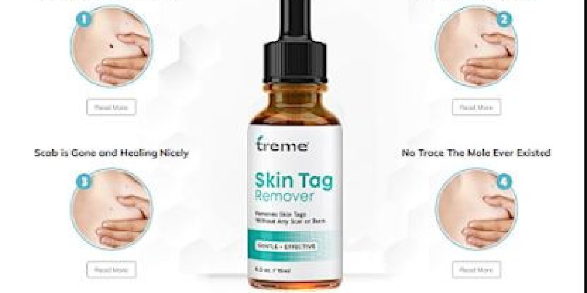 How To Treme Skin Tag Removal Serum For Best Results? [Latest 2024]