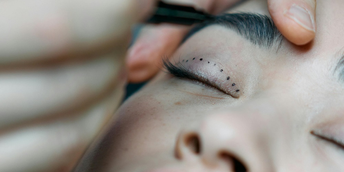 Eyelid Surgery for Puffy Eyes: Glamorous Clinic’s Solution