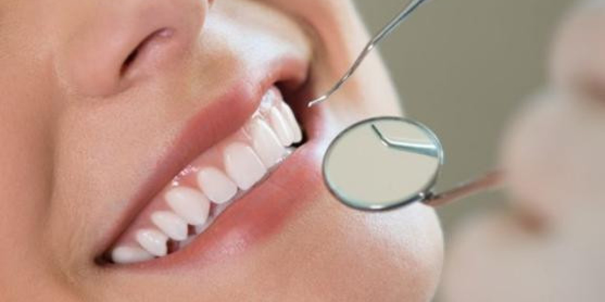 Why Is Teeth Cleaning in Dubai Essential for Your Oral Health?