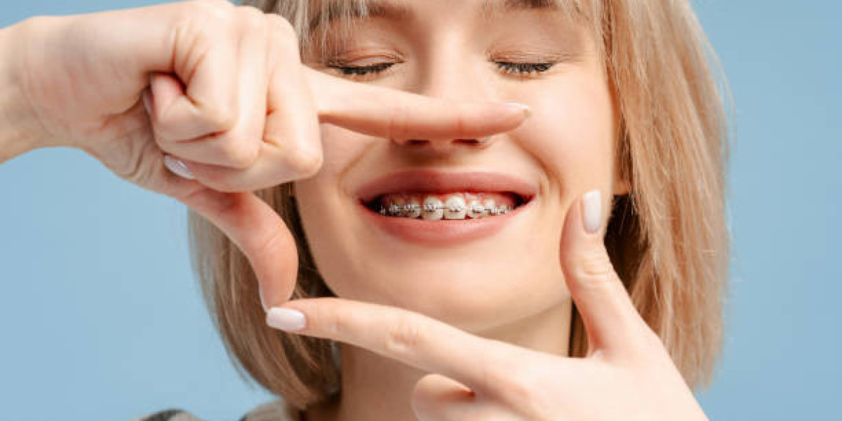 Expert Tips for Orthodontics in Riyadh