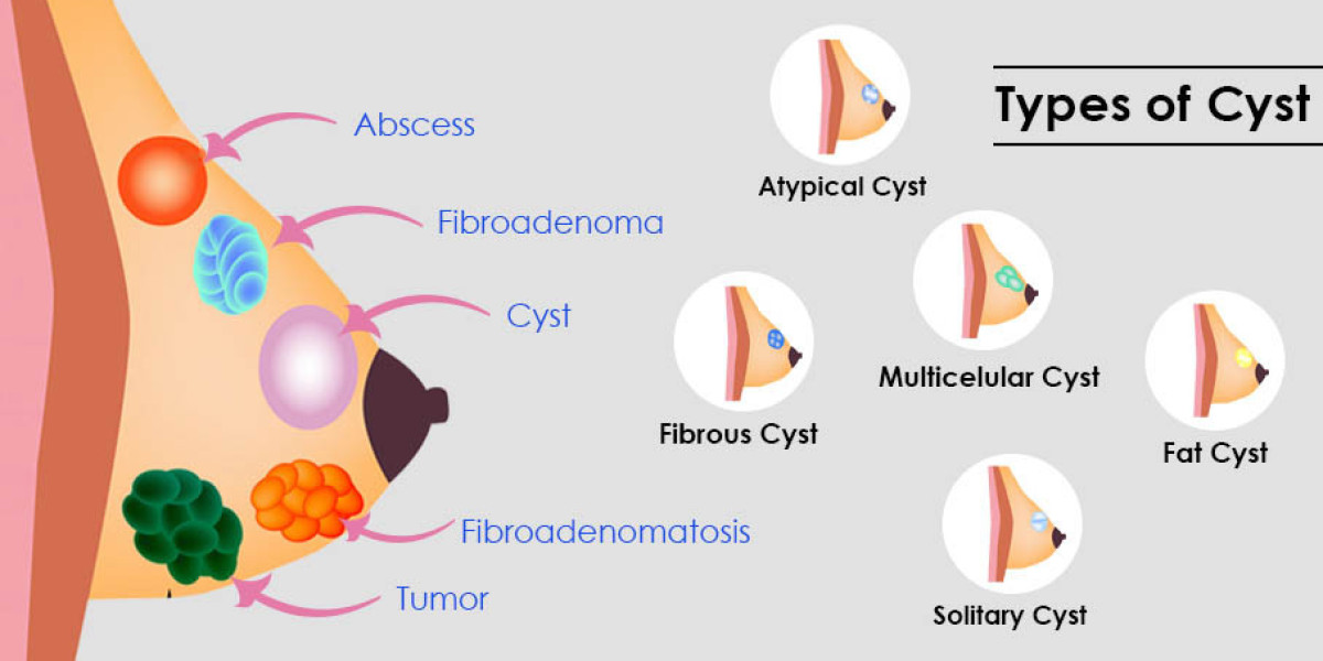 How to Prepare for a Biopsy for Diagnostic Purposes